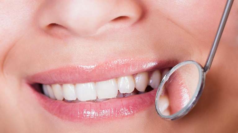 A lady with veneers in West Allis, WI