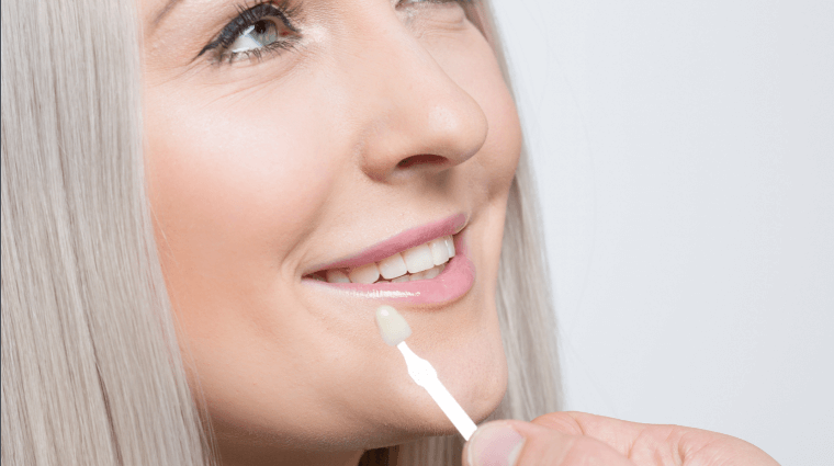 woman getting veneers in milwaukee
