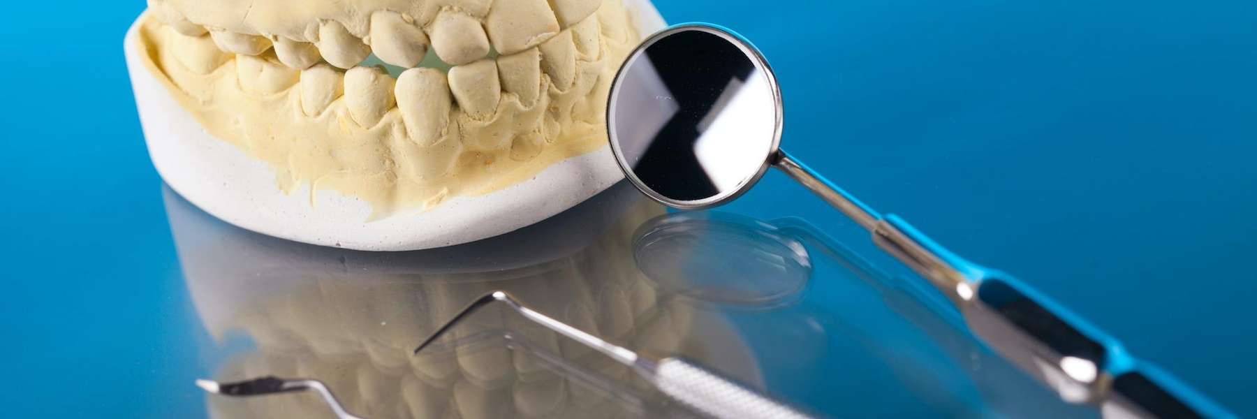 A model of Dental Crowns in West Allis, WI.