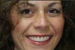 cosmetic dentistry | wisconsin smiles | milwaukee