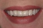 cosmetic dentistry | wisconsin smiles | milwaukee