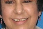Cosmetic Dentistry | Wisconsin Smiles | Milwaukee