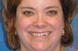 cosmetic dentistry | wisconsin smiles | west allis