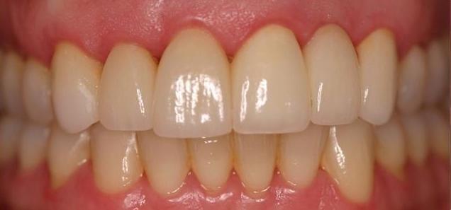 White and straight teeth | Dentist Milwaukee WI